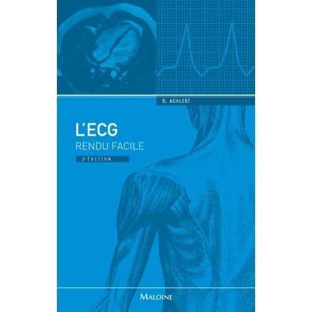 ECG rendu facile