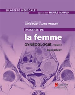 Gynécologie 2