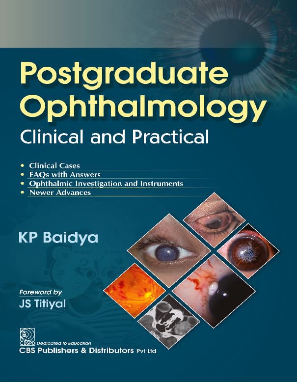 Ophtalmologie KP