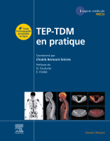 Tep-TDM en pratique
